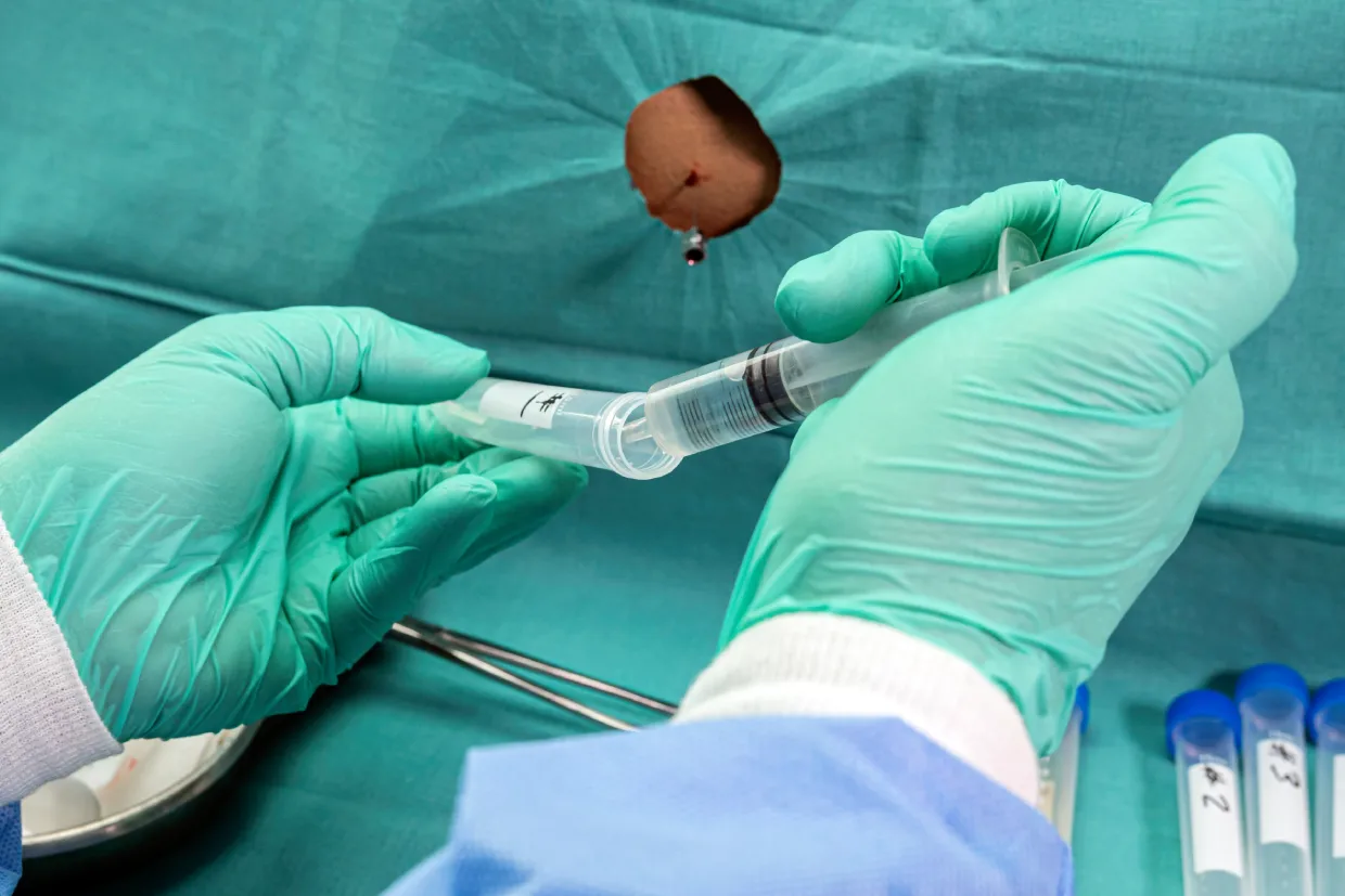 penis-basi-dolgusu-1240x827