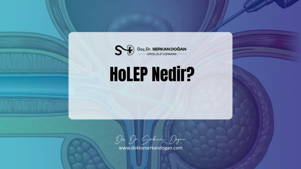 holep-nedir-