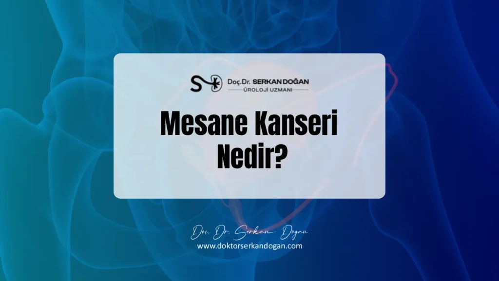 mesane-kanseri-nedir-