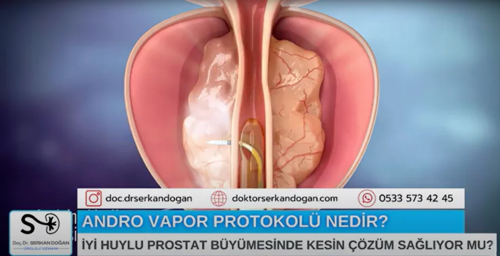 androvapor-protokolu-nedir-1871x961-1.webp
