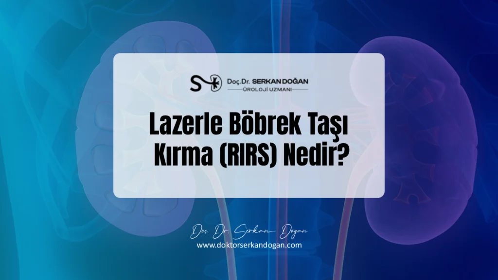 lazerle-bobrek-tasi-kirma-nedir-1441x812-1.webp