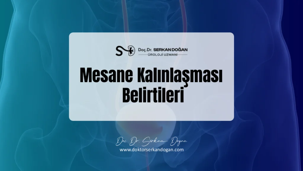 mesane-kalinlasmasi-belirtileri-1441X812.webp