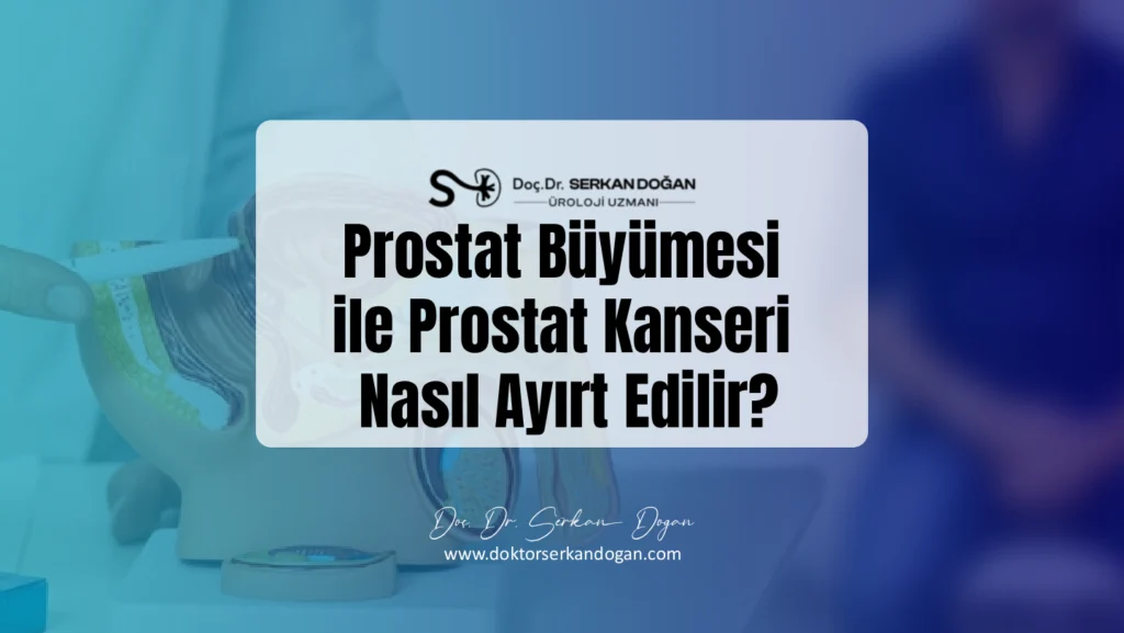 prostat-buyumesi-ile-prostat-kanseri-nasil-ayirt-edilir-1441x812-1.webp