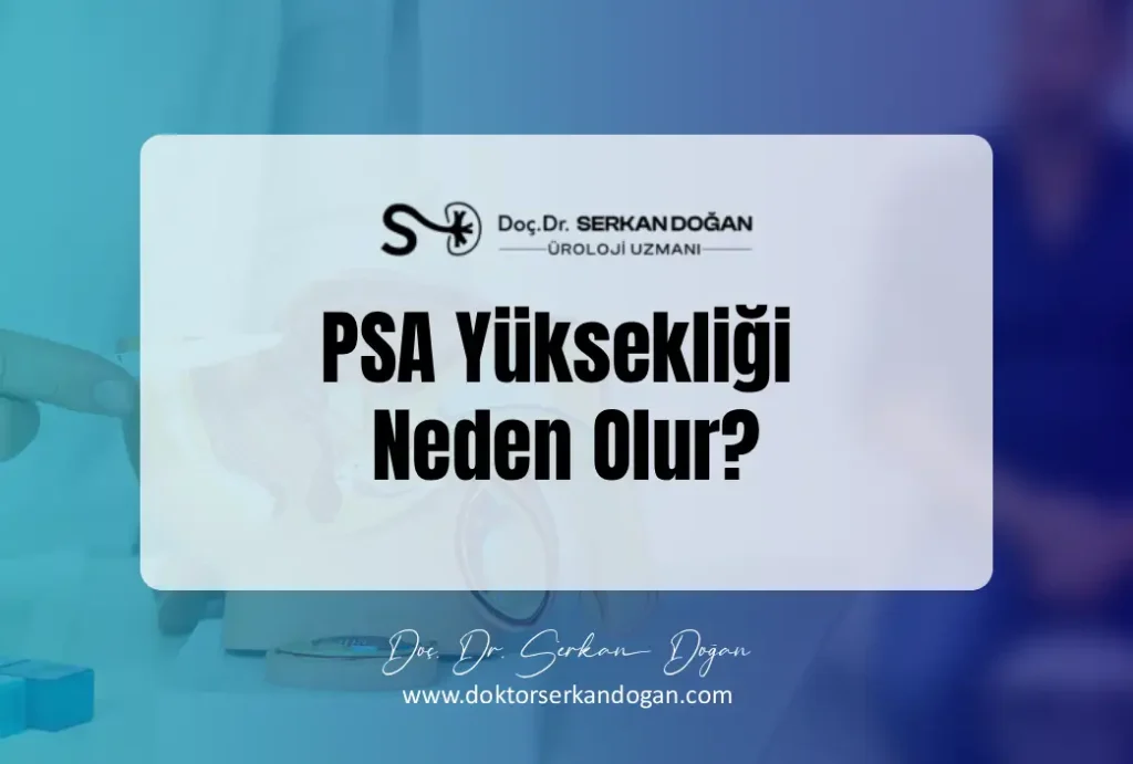 psa-yuksekligi-neden-olur-1043x704-1.webp