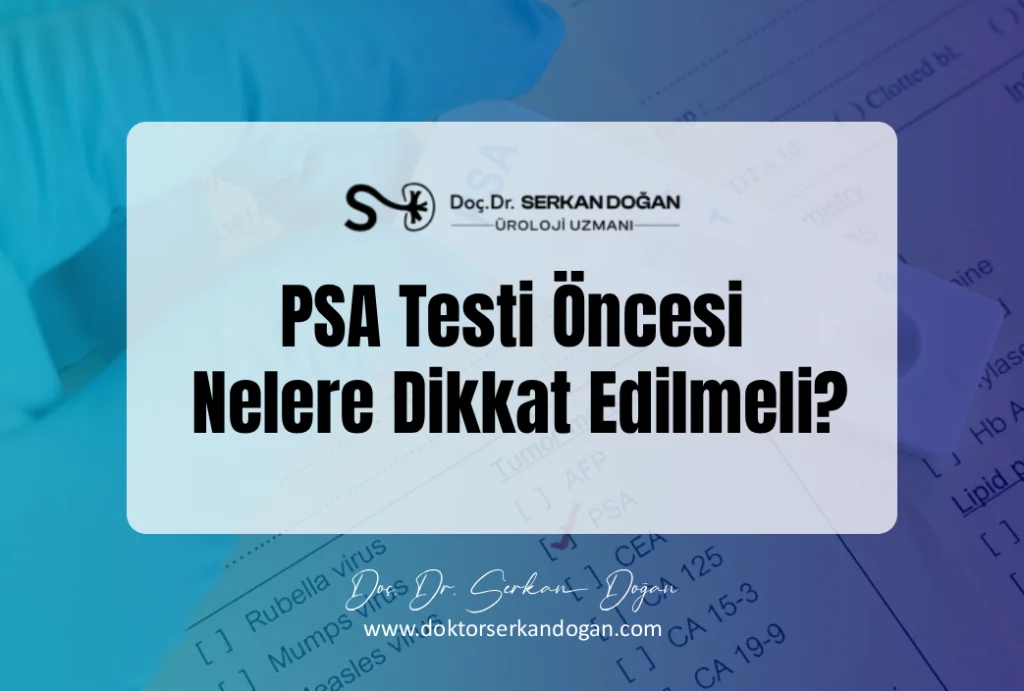 psa testi oncesi nelere dikkat edilmeli?