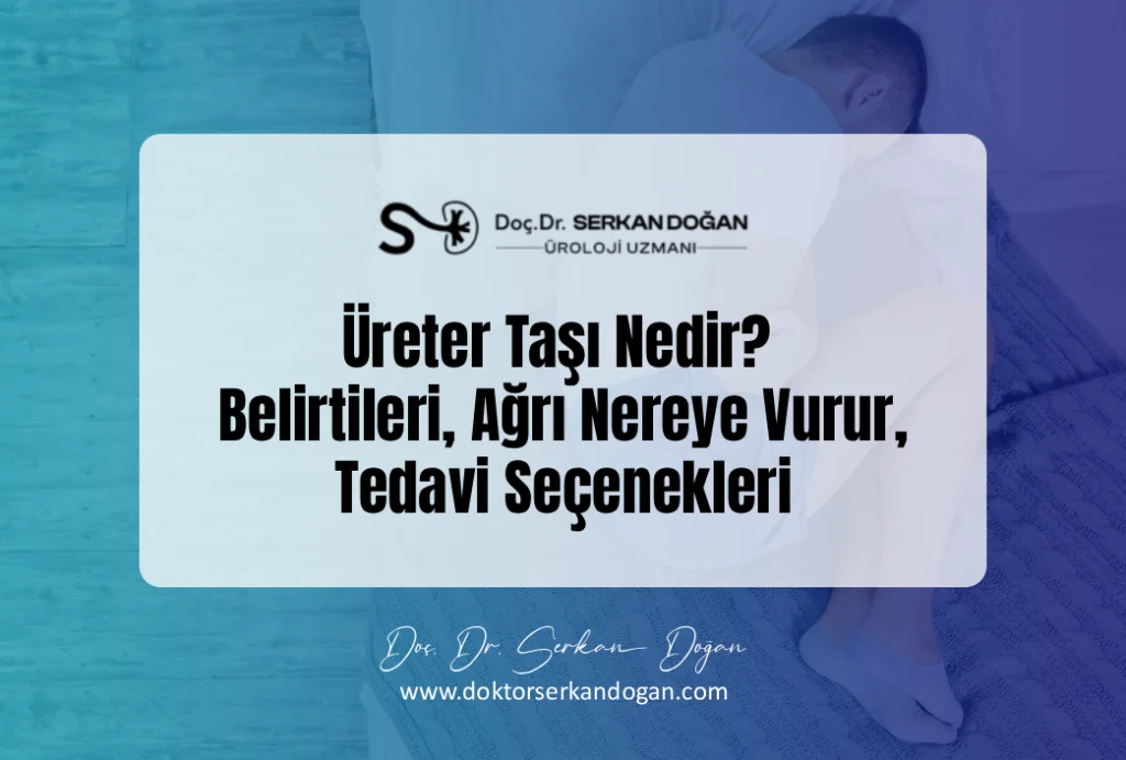 cureter tasi nedir belirtileri ve tedavisi